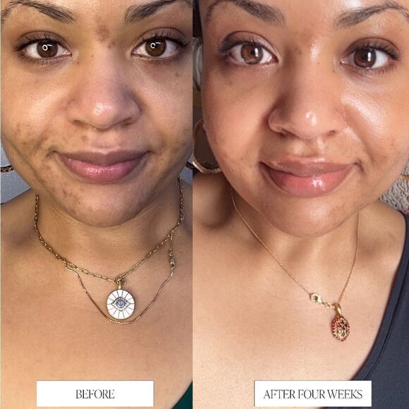 Byroe Tea Celery AHA+LHA Resurfacing Treatment - Picture 5 of 15